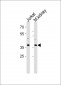 MAPK14 Antibody (Y323)