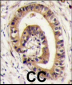 PIST Antibody (C-term)