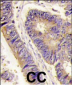 PIST Antibody (Center)