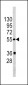 PIST Antibody (Center)