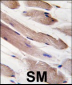 PIK3R1 Antibody (Y580)