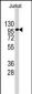 APG1 (ULK1) Antibody (Center)