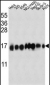 Interferon-inducible protein (IFITM3) Antibody (N-term)