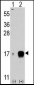 Fagilis (IFITM3) Antibody (Center)