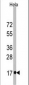 Fagilis (IFITM3) Antibody (Center)