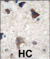 CDH4 Antibody (N-term)