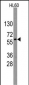 Nucleostemin (GNL3) Antibody (Center)