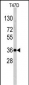 Nanos Homologue 1 (NANOS1) Antibody (C-term)