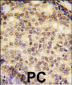 SOX9 Antibody (N-term)