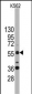 SOX9 Antibody (N-term)