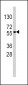 SOX9 Antibody (Center)