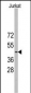 YBX2 Antibody (Center)