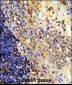 CD8A Antibody (N-term)