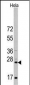 CD8A Antibody (N-term)