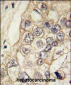 K Cadherin (CDH6) Antibody (C-term)