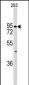 K Cadherin (CDH6) Antibody (C-term)