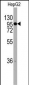 CHRD Antibody (C-term)