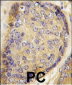 Latexin Antibody (Center)