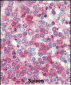 Latexin Antibody (Center)