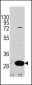 Latexin Antibody (Center)