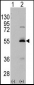 ALDH6A1 Antibody (C-term)