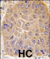 ALDH5A1 Antibody (N-term)