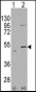 ALDH5A1 Antibody (N-term)