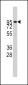 ADAM17 Antibody (N-term)