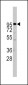 ADAM17 Antibody (C-term)