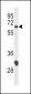 CD4 Antibody (N-term)