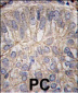 CDH3 Antibody (C-term)