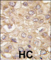 DRAM Antibody (C-term)