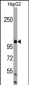 AMBRA1 Antibody (N-term)