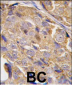 EIF4B Antibody (S422)