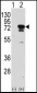 EIF4B Antibody (S422)