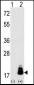 EIF4EBP1 Antibody (T69)