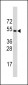 RNF36 (TRIM69) Antibody (Center K251)