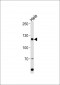 HIRA Antibody (Center)