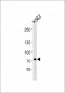 SOX30 Antibody (Center)