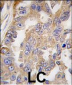 AGR2 Antibody (Center)