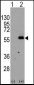 MEF2C Antibody (S396)