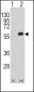 MEF2C Antibody (T300)