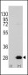 HSP27 (HSPB1) Antibody (S78)