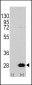 HSP27 (HSPB1) Antibody (S78)