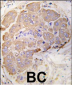 HSPB1 Antibody (S82)