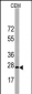 BarX1 Antibody (C-term)