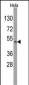 ILK Antibody (S246)