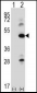 ILK Antibody (S246)