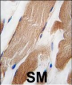 ILK Antibody (T173)