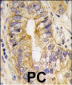 PDGFRA Antibody (Y768)